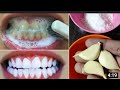 Gyaran Hakori A Minti 3 Minute Teeth Whitening Garanjiki Hakori Toothcure Magani Hausa Yadaake 