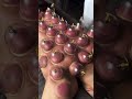 Dry Cupping Therapy 💪 | Effective Solution for Muscle Pain &amp; Recovery