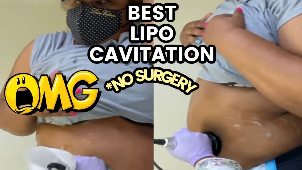 ULTRASONIC BODY CAVITATION Lipo Laser Review before and after Did