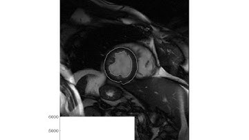 ELEC4630 - Image Processing and Computer Vision - Assignment 2