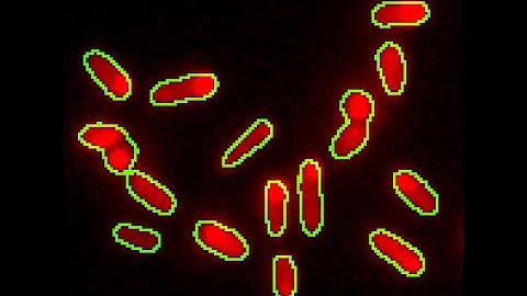 Single cell segmentation using Fiji/ImageJ