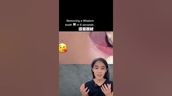 拔智齿可以请领保险吗#简单拔牙#手术拔牙 - 天天要闻