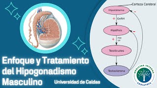 Enfoque y Tratamiento del Hipogonadismo Masculino