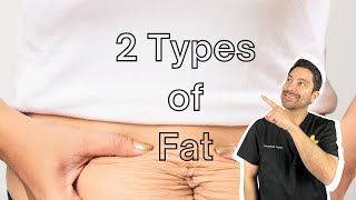 Subcutaneous vs. Visceral Fat: Which Is Worse??