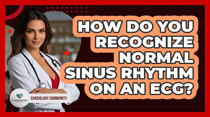How Do You Recognize Normal Sinus Rhythm On An ECG? - Cardiology Community