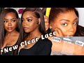 😱Scalp Or Lace? *New* Clear Scalp Lace &amp; Natural Hairline Wig|😍20% OFF| ft. XrsBeautyHair