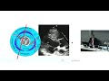 Echocardiographic Imaging in TAVI - Prof Greg Scalia