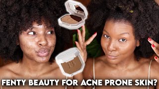 FENTY BEAUTY POWDER FOUNDATION REVIEW ON ACNE PRONE, TEXTURED SKIN | DEMO, WEAR TEST | KENSTHETIC screenshot 5