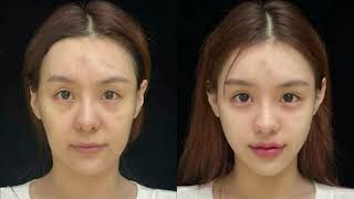experimental symmetrical facial alignment 𝜗ৎ