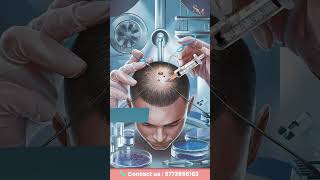 Baldness Treatment Guide | Minoxidil, Finasteride & Hair Transplant #shorts #hairtransplant