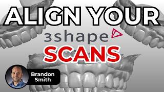 The 5 Minute Trick to Align 3Shape Scans - ep 0052