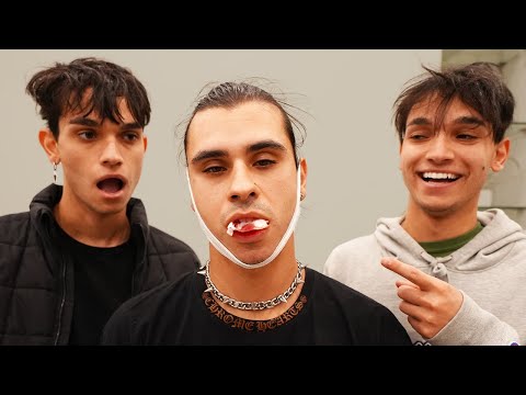OUR BROTHER GOT HIS WISDOM TEETH REMOVED!