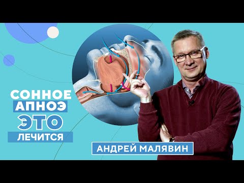 Сонное АПНОЭ: как обнаружить и что с ним делать?