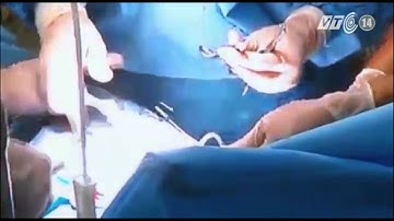 VTC14_Mổ ruột thừa trực tuyến cứu bệnh nhân đảo Trường Sa lớn