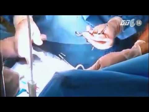 Video VTC14_Mổ ruột thừa trực tuyến cứu bệnh nhân đảo Trường... - youtube