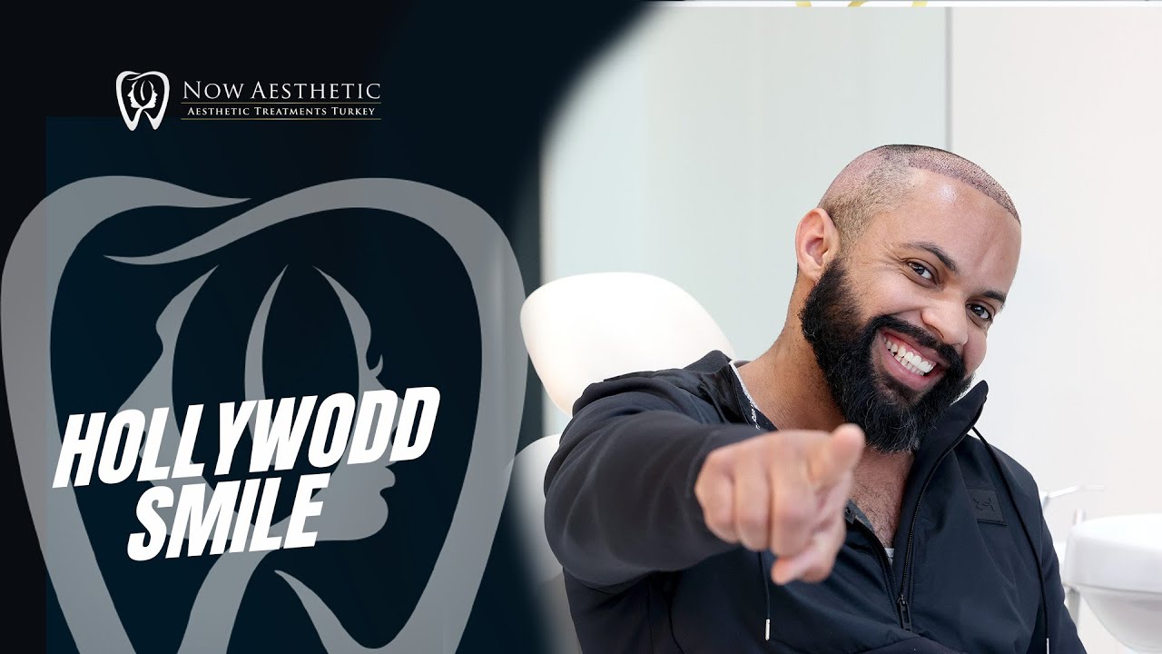 Smile Makeover: Hollywood Smile!