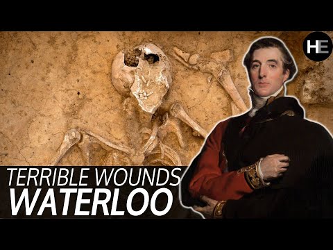 The most BRUTAL wounds from the Battle of Waterloo