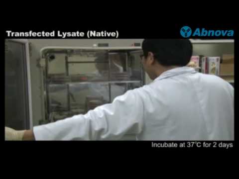Video: În lizate de reticulocite de iepure?