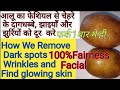 आलू से फेशियल कैसे करें Apni Skin ko10गुना Fair kare Remove Black Spots,Wrinkles,Tanning from POTATO