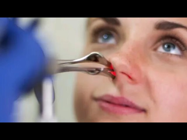 Атрофический ринит--Atrophic rhinitis