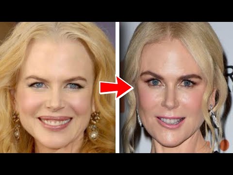 WHAT CHANGES DID NICOLE KIDMAN MAKE TO HER FACE?