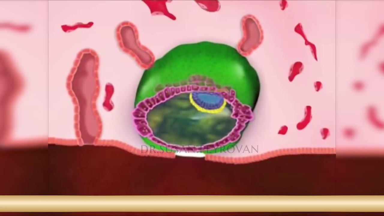 لانه گزینی | متخصص زنان و زایمان و درمان های فوق تخصصی ناباروری | دکتر سوزان پیروان | Nesting