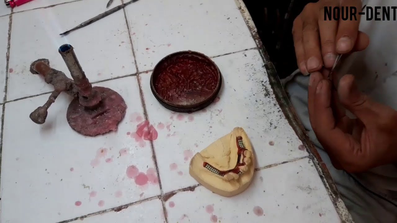 Élaboration d'un châssis métallique ou stellite (1ère partie).