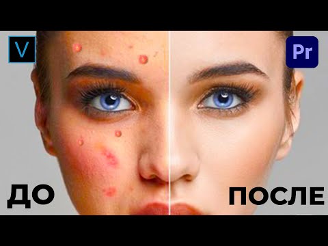 КАК УБРАТЬ ПРЫЩИ НА ВИДЕО ОДНОЙ КНОПКОЙ