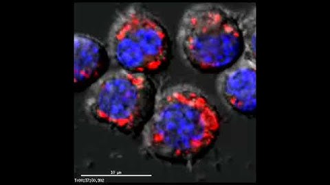 Macrophage vs E. coli pHrodo red