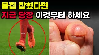 물집 잡혔을 때 확실한 치료 방법  l 물집 빨리 낫는법