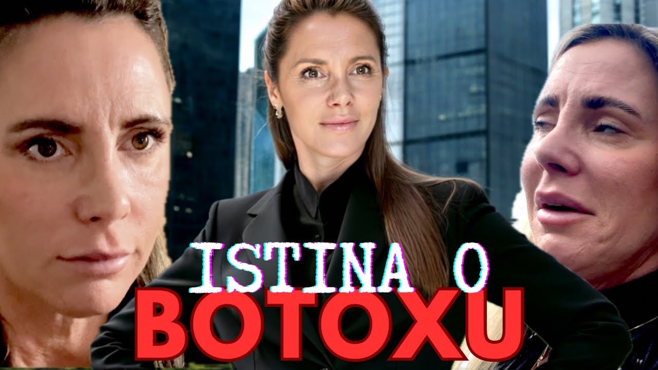 Botox- Šokirala sam se kad sam vidjela svoje lice!