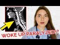 28 YEAR OLD PARALYZED IN HIS SLEEP!! Real Medical Case