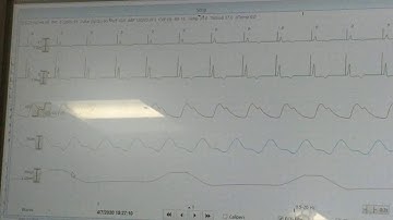How to print a strip from a central monitor at UH