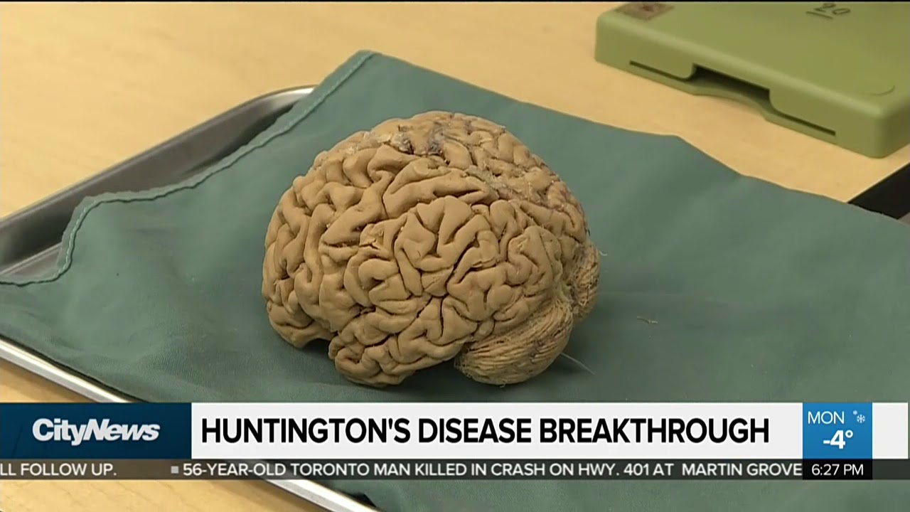 new research on huntington's disease