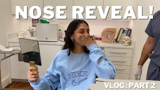 Nose Job Vlog Part 2: The Reveal! Cast Removal + Reaction | Harley Street London