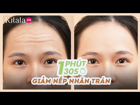 Video: Làm thế nào để điều trị rãnh chân: 11 bước (có hình ảnh)