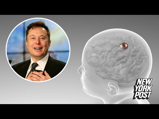 Elon Musk's startup Neuralink implants chip into brain of first human test subject - YouTube