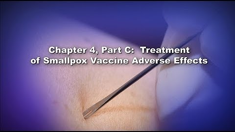 Chapter 4, Part C: Treatment of Smallpox Vaccine Adverse Events