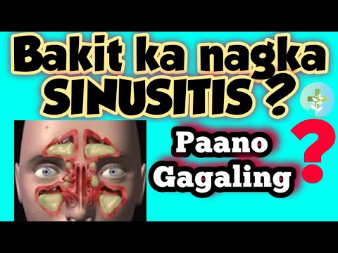 Video: Sinusitis Sa Mga Bata: Kung Paano Maiiwasan Ang Mga Komplikasyon