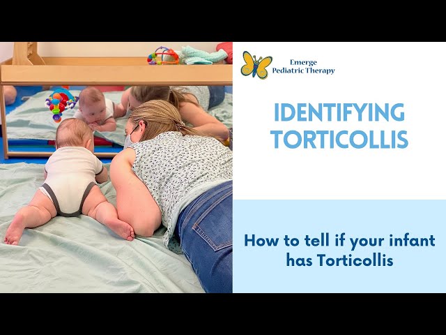 How to Tell if Your Baby Has Torticollis class=