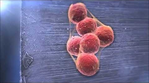 contamination of surgical instruments