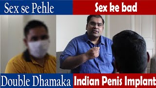 इनके तो लिंग लम्बे और खड़े हो गए | Penile Implant Double Review Hindi