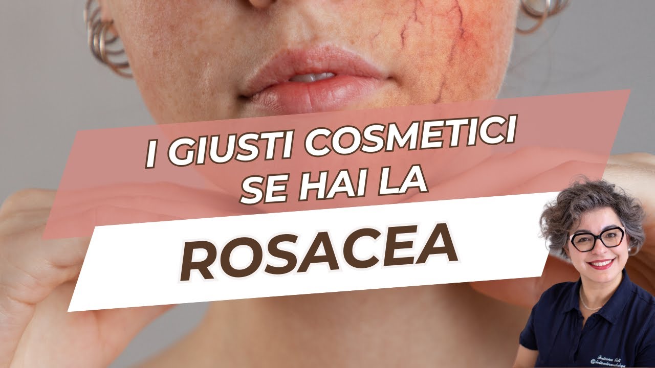 🔴✨ Rosacea o couperose? Ecco come scegliere i cosmetici giusti!