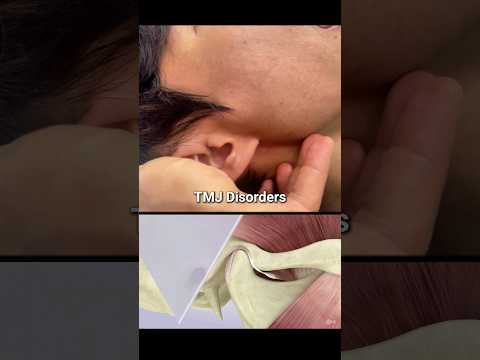 Temporomandibular joint disorder