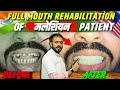 Malaysia   full mouth rehabilitation 