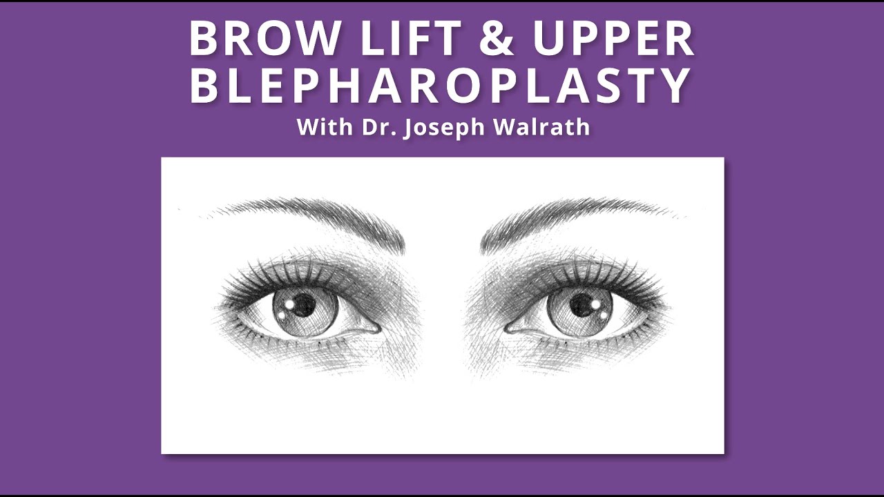 Upper Blepharoplasty and Brow Lift Surgery