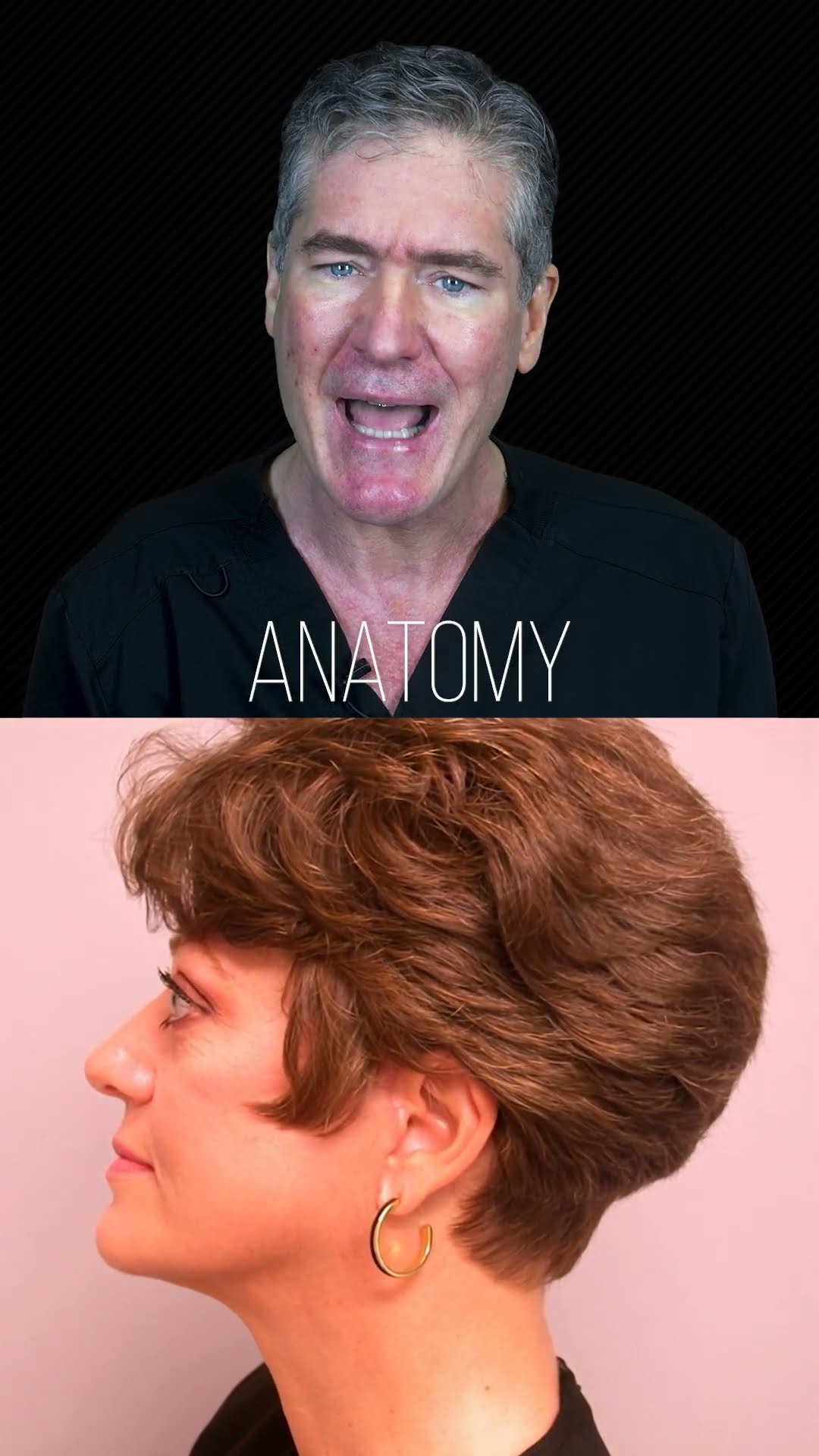 What is a deep plane facelift?