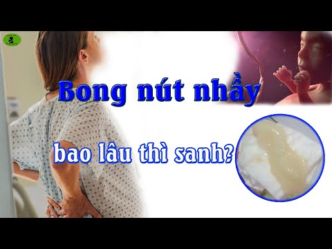 Video: Bao lâu sau khi bạn mất nút nhầy Bạn đã chuyển dạ?