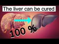 Fatty liver diet: 7 best foods 🍎  for fatty liver | How to reduce fatty liver