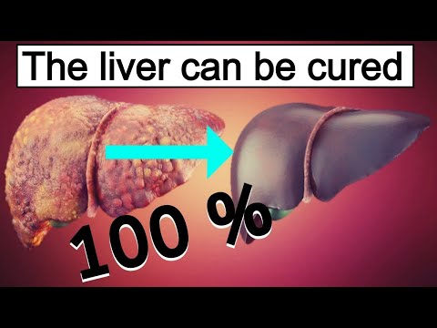 Fatty liver diet: 7 best foods 🍎  for fatty liver. How to reduce fatty liver
